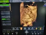 20230515 210534